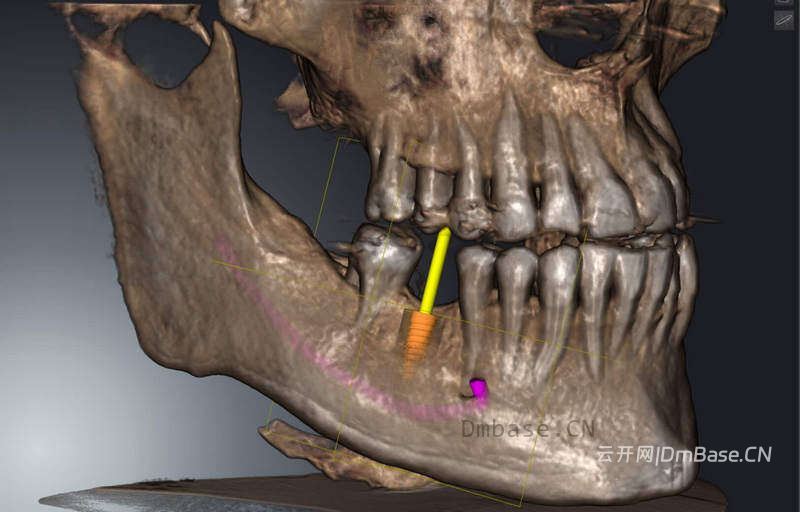 Dental Image Suite 1.14.0.0_牙科影像管理软件