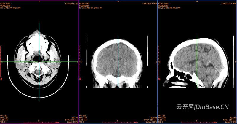 Sante DICOM Viewer Pro 14.4.1_医学影像DICOM查看软件