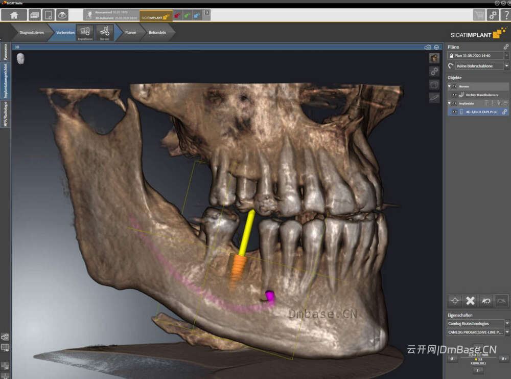 Dental Image Suite 1.14.0.0_牙科影像管理软件