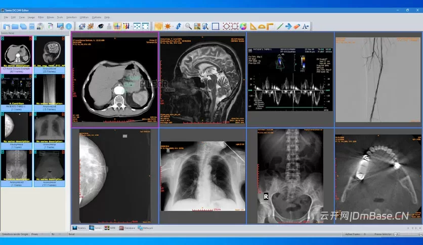 Sante DICOM Editor V10.5_DICOM编辑与PACS管理软件