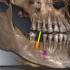 Dental Image Suite 1.14.0.0_牙科影像管理软件