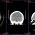 Sante DICOM Viewer Pro 14.4.1_医学影像DICOM查看软件