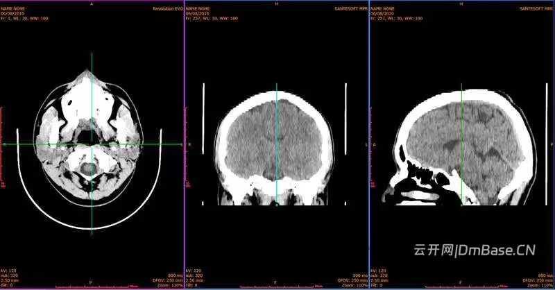 Sante DICOM Viewer Pro 14.5.1_医学影像DICOM查看软件