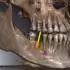 Dental Image Suite 1.14.0.0_牙科影像管理软件