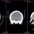 Sante DICOM Viewer Pro 14.4.1_医学影像DICOM查看软件